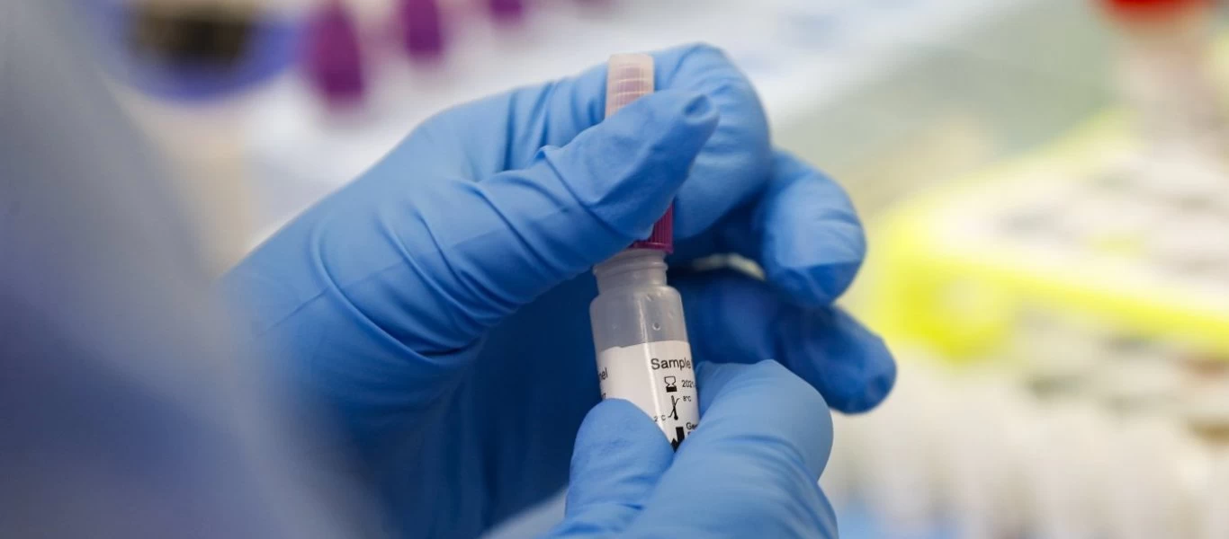 Bloomberg: Δημιουργήθηκε αντίσωμα που μπορεί να «νικήσει» τον νέο κορωνοϊό